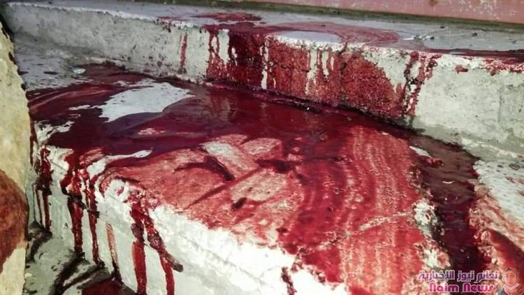 استشهاد شخصين من المدنيين وجرح آخرين جراء قصف عنيف منذ عصر اليوم تشنه ميلشيات الحوثي على الأحياء السكنية وسط مدينة تعز