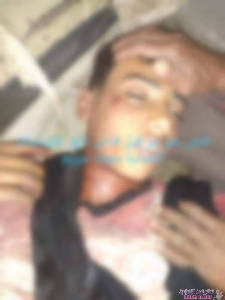 لحج : مقتل طفل برصاص قناص حوثي في مديرية القبيطة ______