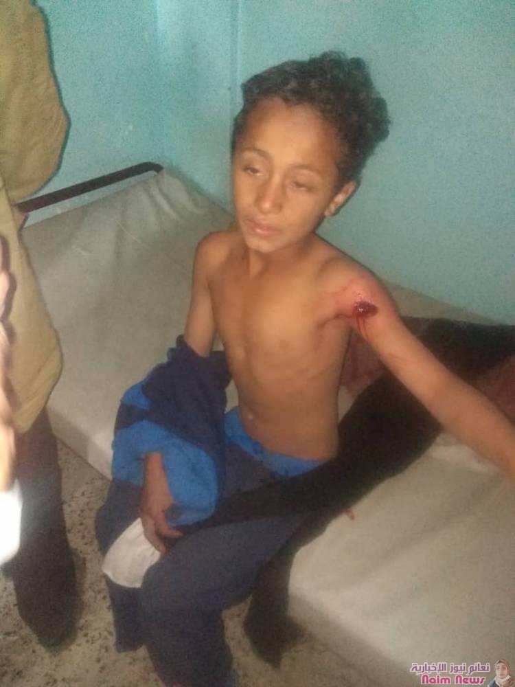 عااااااجل #انتهاكات وجرائم حوثيه جديده بحق الطفوله في #الشقب بوابة #تعز #اليمن* 