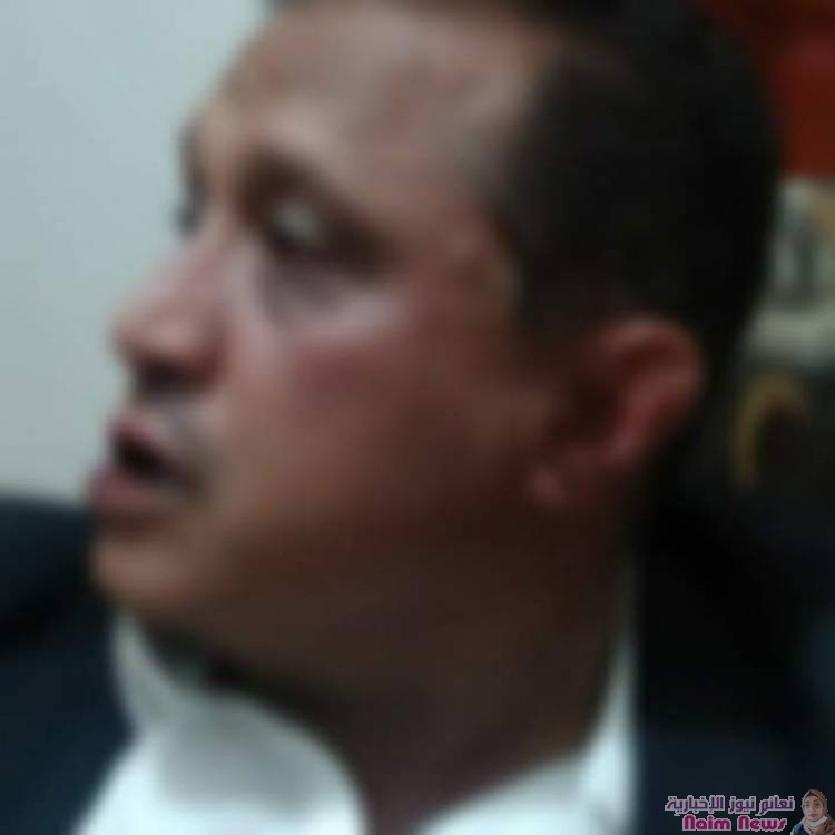 العتداء على الصحفي مجلي الصمدي