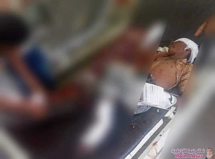الحديدة| ‏إصابة الطفل عدنان طاهر حشاش"