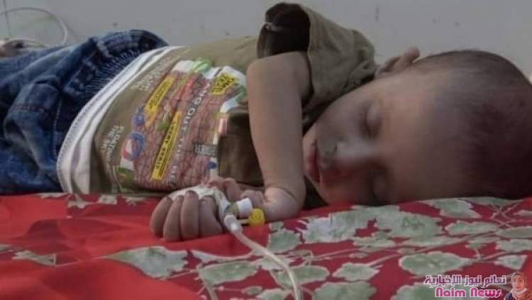 الصحة العالمية : تسجيل 413 وفاة وأكثر من 34 ألف إصابة بوباء الحصبة باليمن خلال 7 أشهر