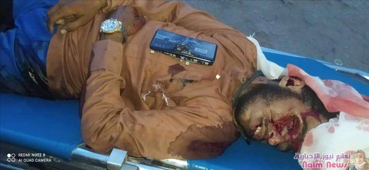 العثور على جثة قتيل مجهول الهوية بزنجبار (صورة)