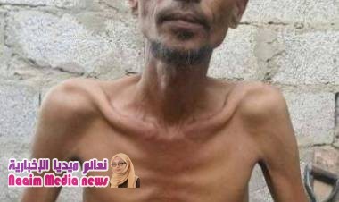 وفاة فنان تهامي بسبب الجوع وناشطون ينشرون آخر صورة له قبل الوفاة