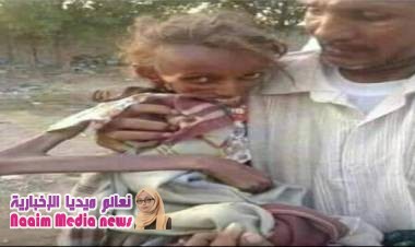  كارثة صحية بالحديدة