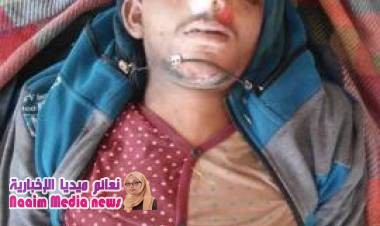 العثور على جثة مجهولة الهوية وسط مدينة إب