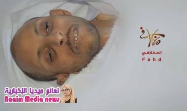 مليشي الحوثي تقتل المدنيين دون رحمه