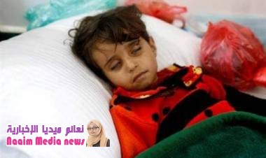 بعد الكوليرا وحمى الضنك ..آفة اخرى تفتك باليمنيين