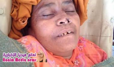 مليشيا الانقلاب تقتل امرأة مُسِّنة بمديرية حيفان جنوب تعز 