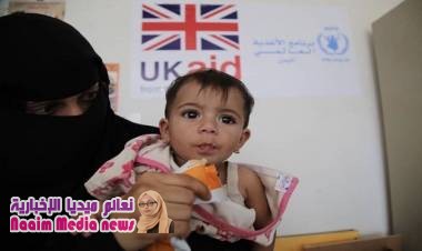مساعدات بريطانية بـ 96.5 مليون جنيه لمواجهة سوء التغذية في اليمن