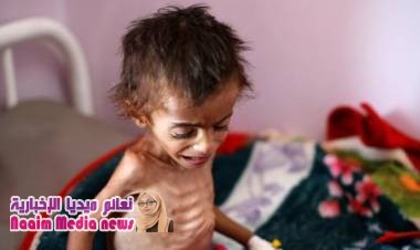 14 مليون شخص على شفا المجاعة خلال الأشهر القليلة المقبلة في اليمن