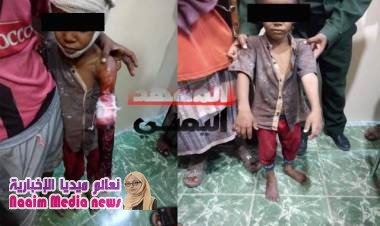 قوات الأمن بالمكلا تلقي القبض على متسولين يمارسون النصب والاحتيال والخداع بطرق غريبة !