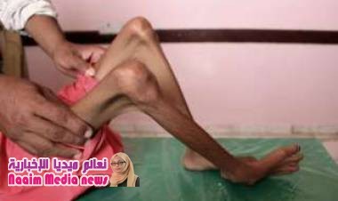 معاناة الأسرة اليمنية ... صراع بين توفير إيجار المنزل وتوفير الغذاء