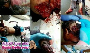 مجزرة حوثيه لاطفال تعز