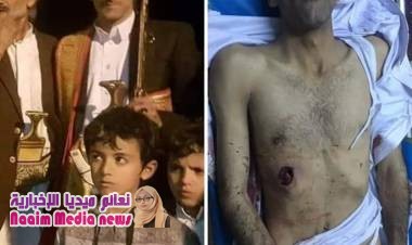 صنعاء::مقتل شاب يوم زفافه ع يد مليشيا الحوثي