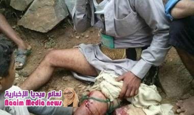  في مشهد قبيح وإجرامي لم يسبق له مثيل حتى من الصهاينة  .