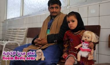 مدير عام مديرية ماوية: هل تستطيع الأمم المتحدة مفاوضة الحوثي على خرائط ألغامه لحماية المدنيين؟