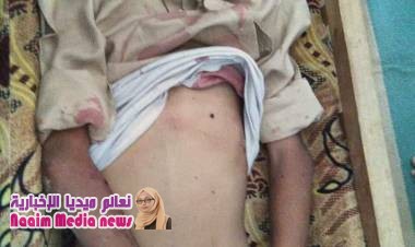 إستشهاد طفل بقصف لمليشيات الحوثي على مدرسة بالصلو  جنوب تعز 