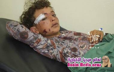 استمرار مليشيا الحوثي  استهداف المدنيين بما في ذلك الأطفال