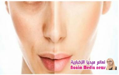 ماهية البوتوكس واستخداماته وكيفية حقنه وأعراضه الجانبية