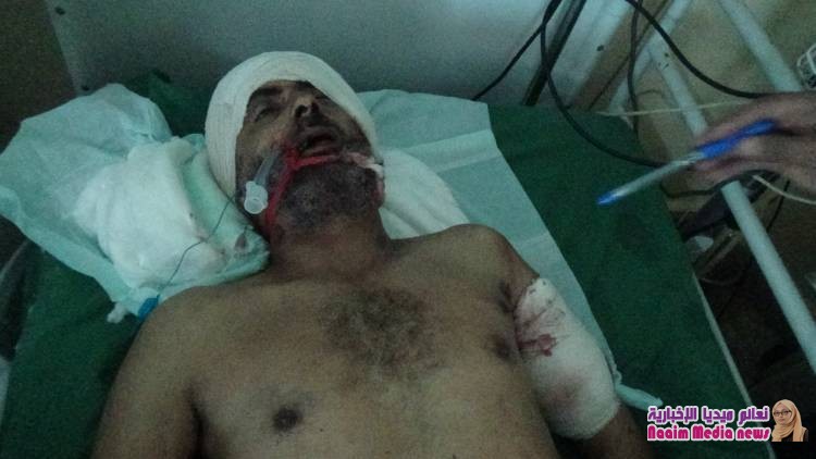 مجاهد على سلطان يقنص من السلال