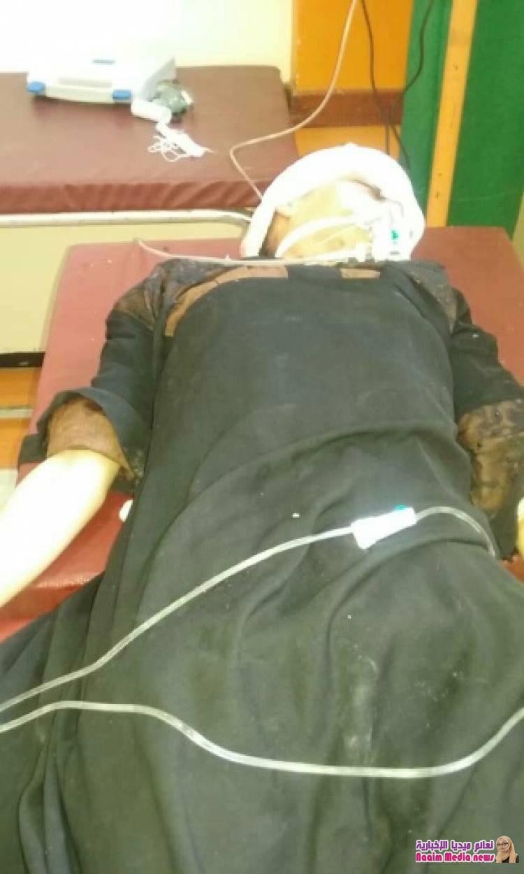 بسمة تستهدف من الحوثة في الدمينة 