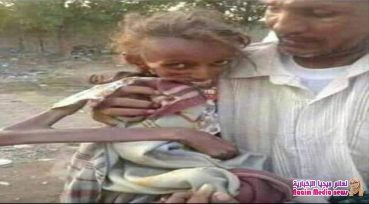  كارثة صحية بالحديدة