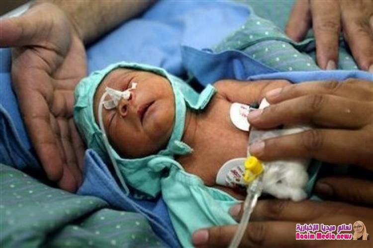 تقرير أممي يرسم "صورة قاتمة" عن وفيات الأطفال في المغرب