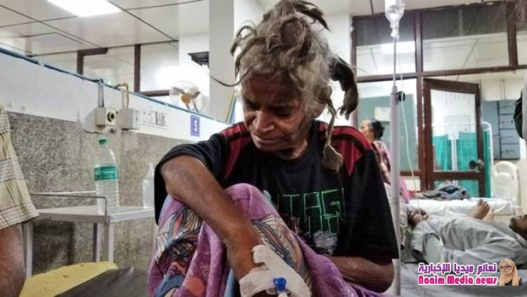 القبض على رجل في الهند "حبس أخته لمدة عامين وعذبها بشكل وحشي"