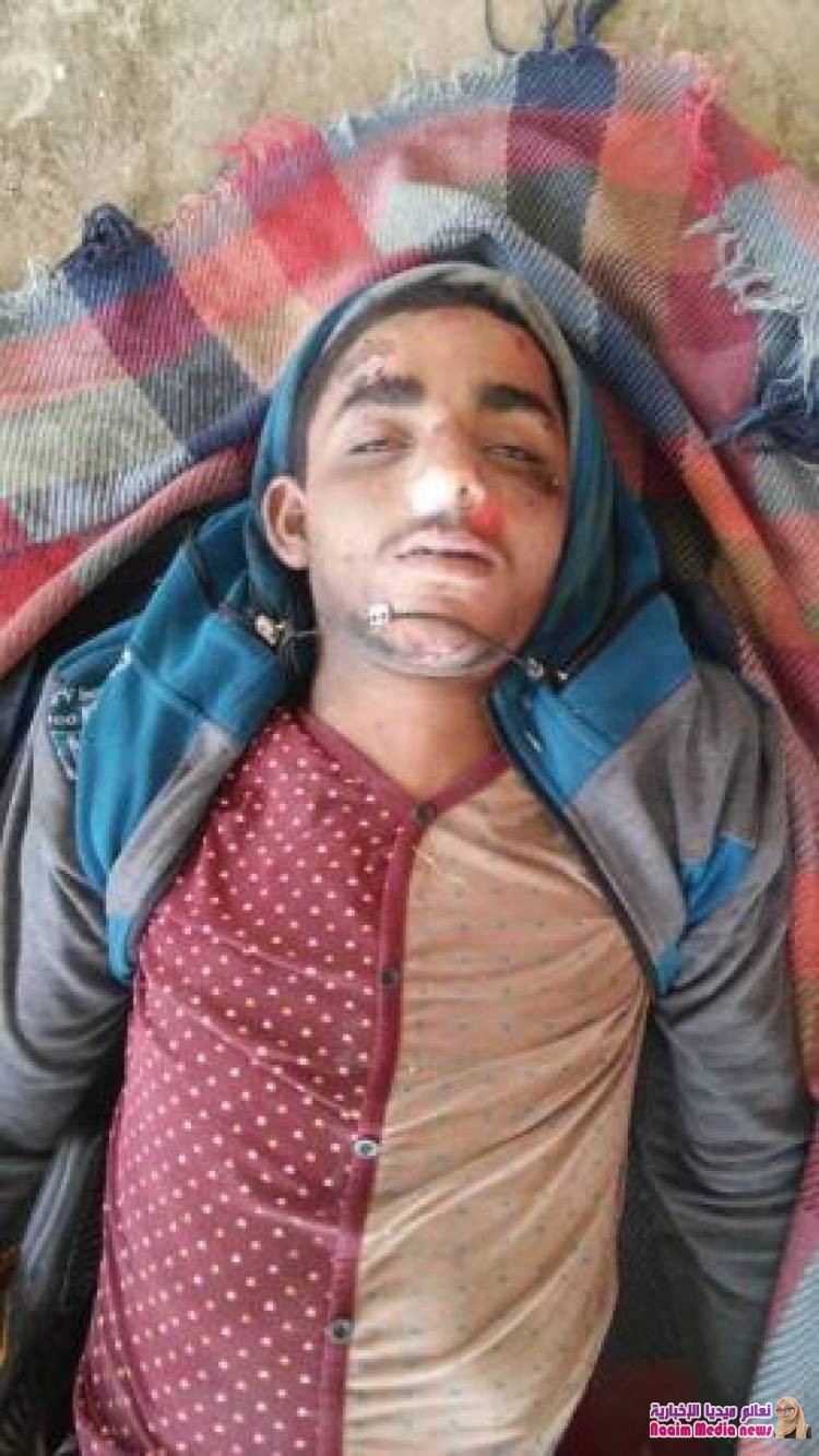 العثور على جثة مجهولة الهوية وسط مدينة إب