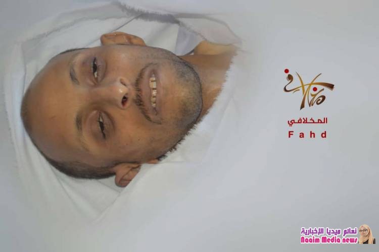 مليشي الحوثي تقتل المدنيين دون رحمه