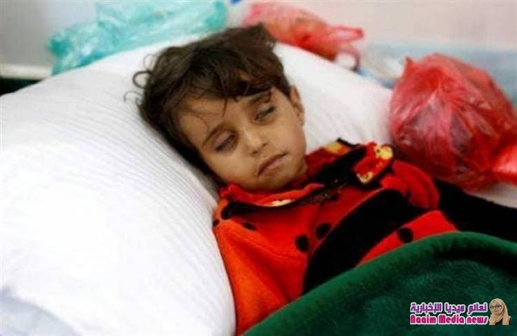 بعد الكوليرا وحمى الضنك ..آفة اخرى تفتك باليمنيين