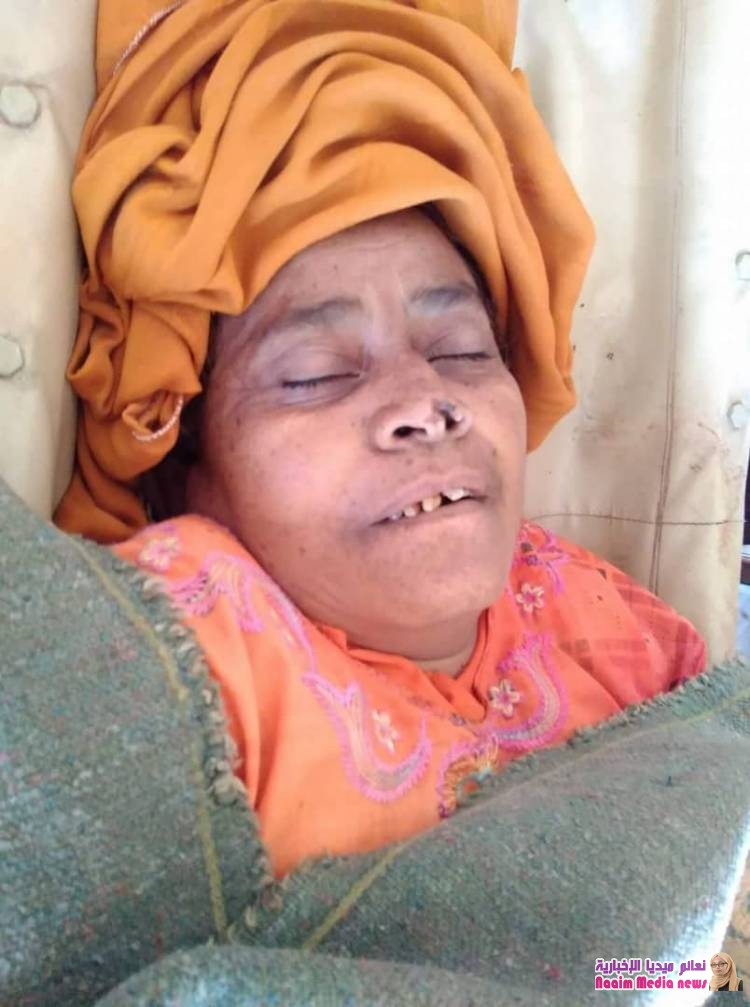 مليشيا الانقلاب تقتل امرأة مُسِّنة بمديرية حيفان جنوب تعز 