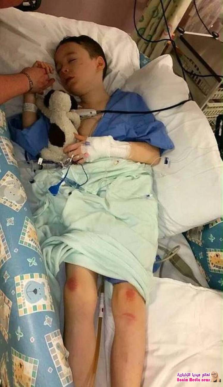 نجاح أول جراحة في العالم لتقويم العمود الفقري