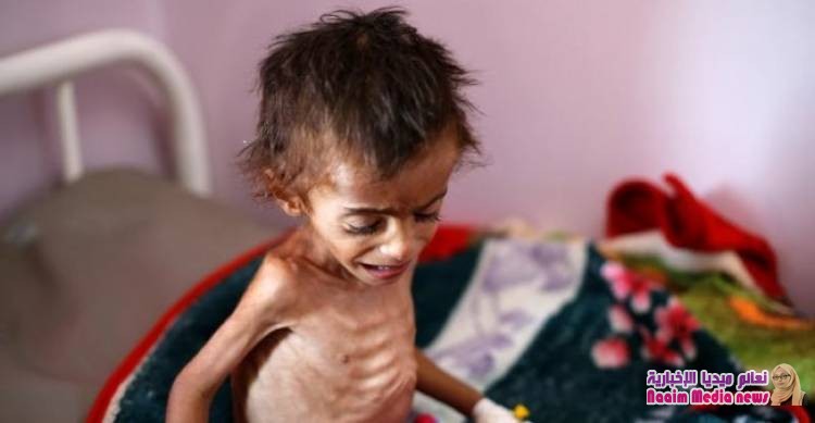 14 مليون شخص على شفا المجاعة خلال الأشهر القليلة المقبلة في اليمن