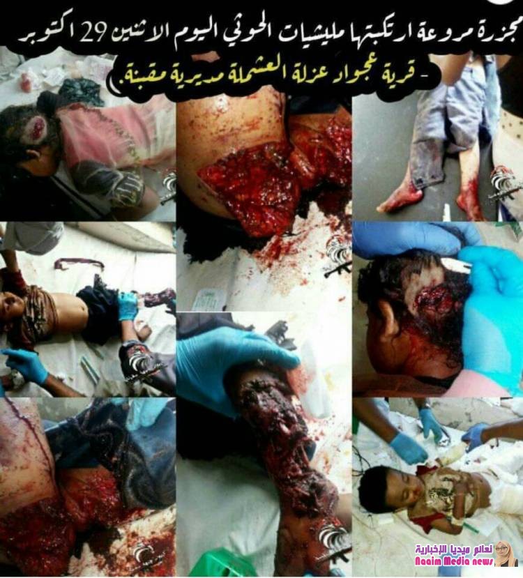 مجزرة حوثيه لاطفال تعز