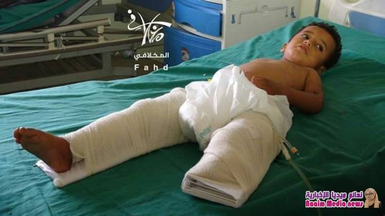 انتهاكات الطفوله 