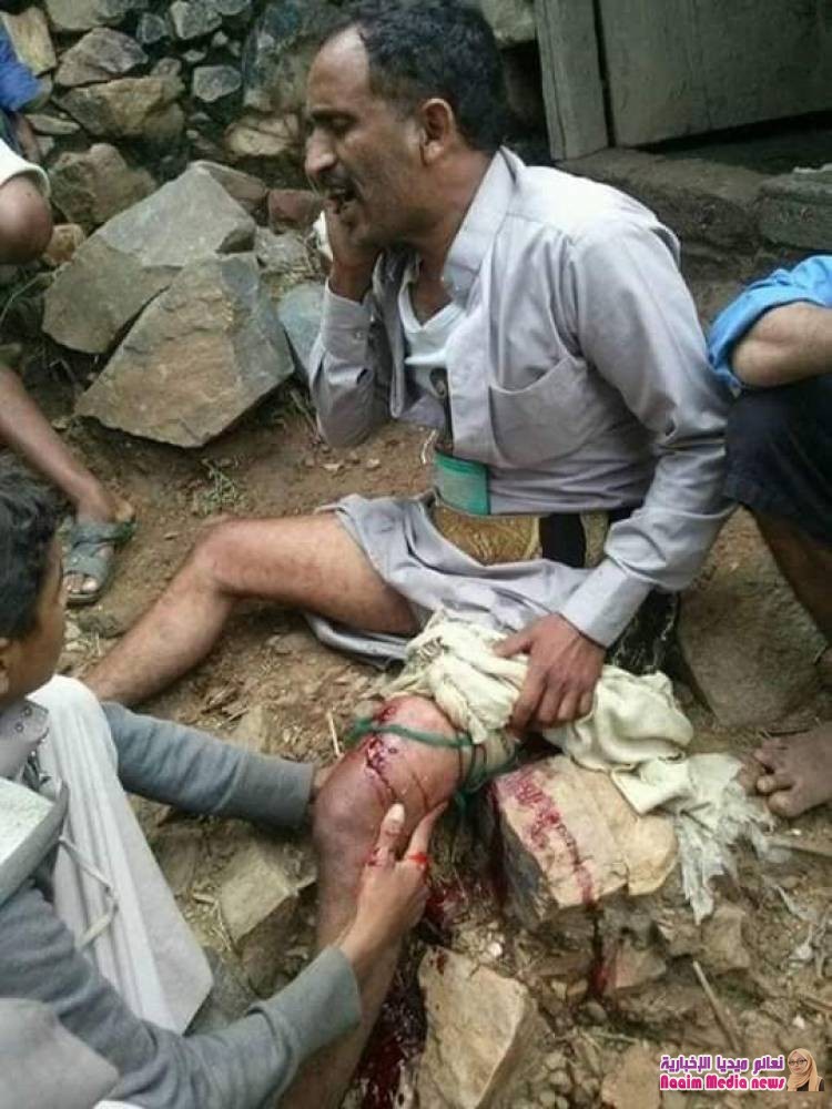  في مشهد قبيح وإجرامي لم يسبق له مثيل حتى من الصهاينة  .