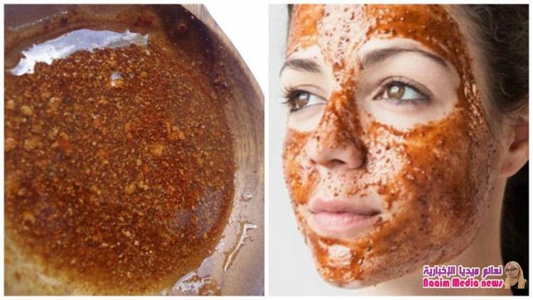 التخلص من آثار حب الشباب بالقرفة