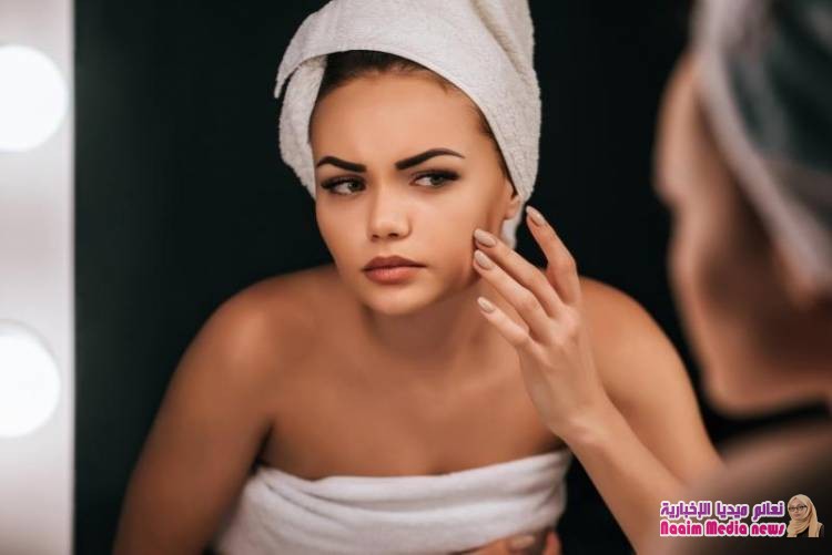 التخلص من آثار حب الشباب بالقرفة