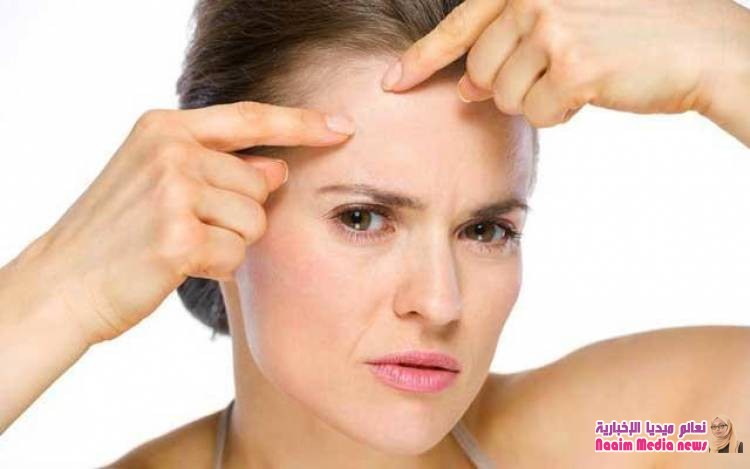 التخلص من آثار حب الشباب بالقرفة