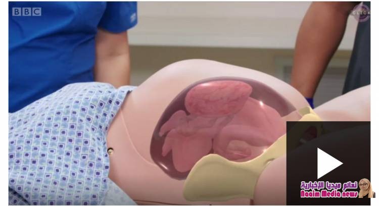 الولادة بتقنية الواقع المعزز