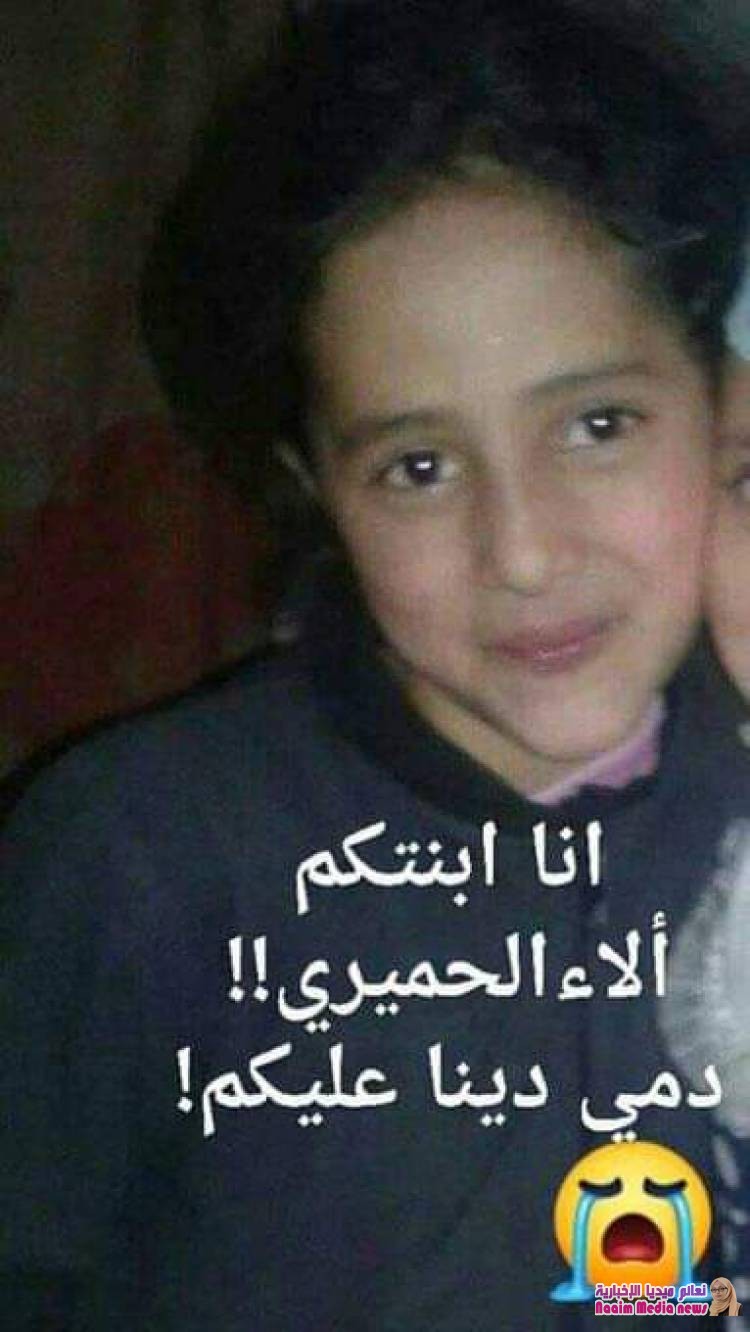 مطالبات القصاص للطفلة الاء