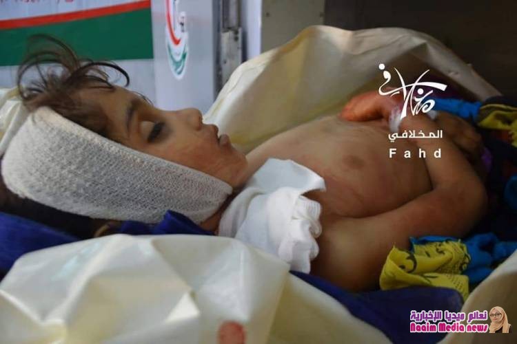 رصاصة قناص حوثي تقتل الطفلة زينب جميل 