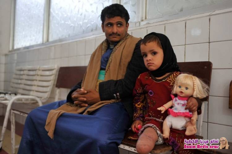 مدير عام مديرية ماوية: هل تستطيع الأمم المتحدة مفاوضة الحوثي على خرائط ألغامه لحماية المدنيين؟