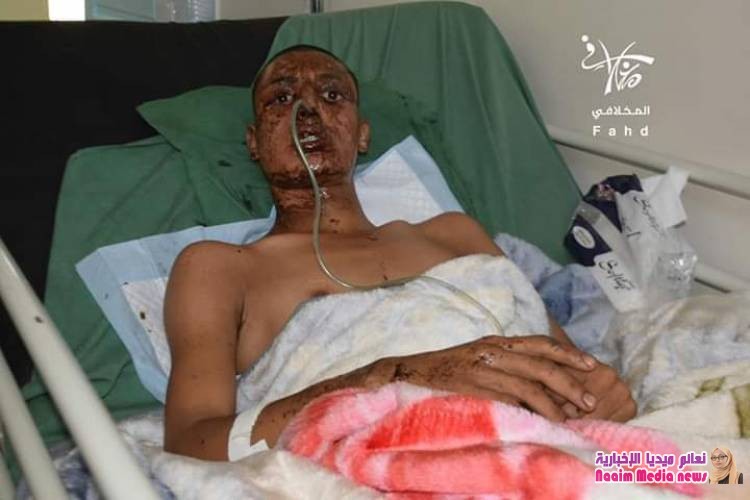 صور لشهداء وجرحى من افراد الجيش الوطني نتيجة   إنفجار عبوة ناسفة 