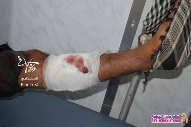 صور لشهداء وجرحى من افراد الجيش الوطني نتيجة   إنفجار عبوة ناسفة 