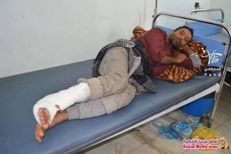 صور لشهداء وجرحى من افراد الجيش الوطني نتيجة   إنفجار عبوة ناسفة 