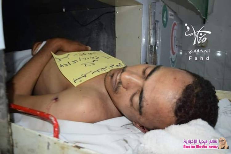 صور لشهداء وجرحى من افراد الجيش الوطني نتيجة   إنفجار عبوة ناسفة 