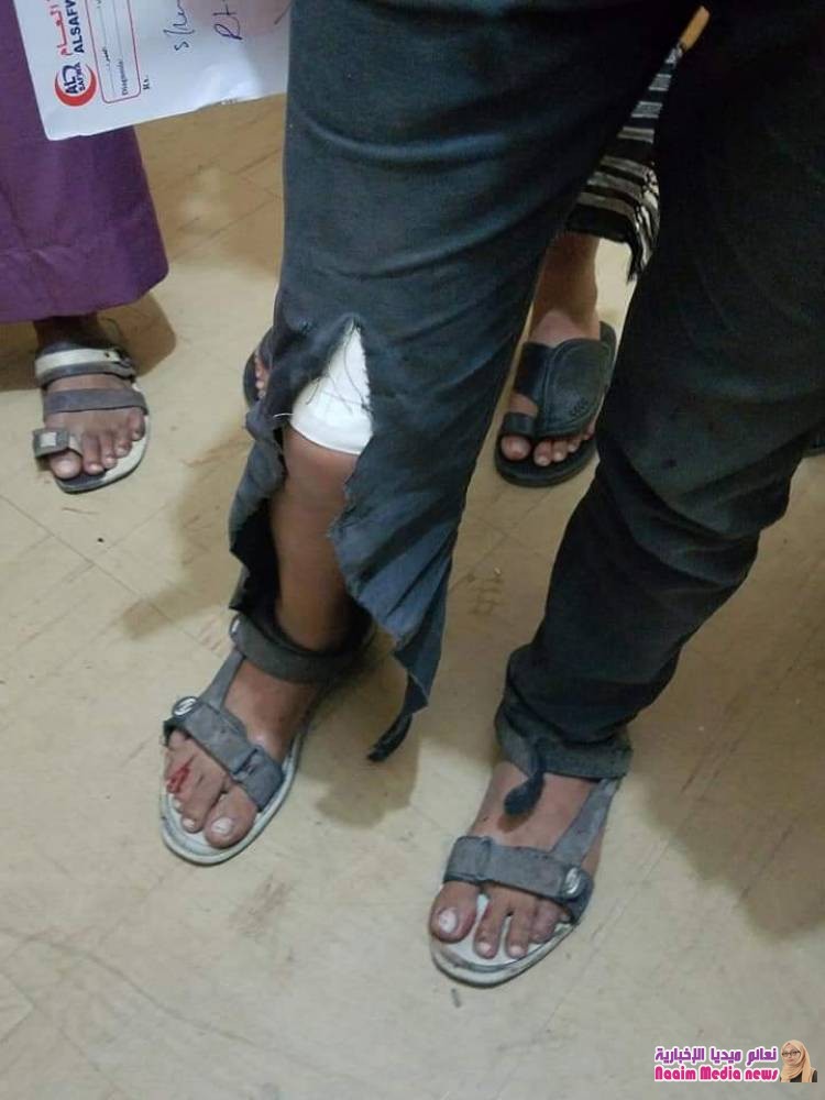  عااااجل ... اصابة 6 مواطنيين بينهم أطفال في ساحة الحرية بتعز